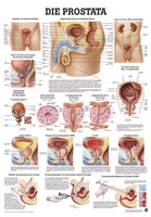 Anatomische Lehrtafel - Die Prostata